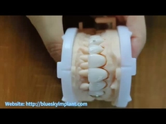 Corone di zirconia con gioielli