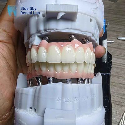 comprare Implantazione in zirconia a strati Personalizzazione Implantazione a arco completo online manufacture