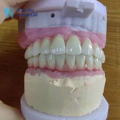 comprare Compatibilità universale Ponte Malo in metallo con telaio in titanio puro online manufacture