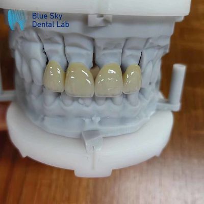 comprare Circonia resistente stratificata con porcellana online manufacture