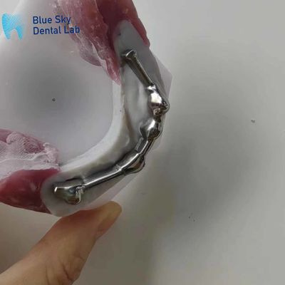 comprare Bar di titanio dentale personalizzabile con denti di abutment per protesi dentali online manufacture
