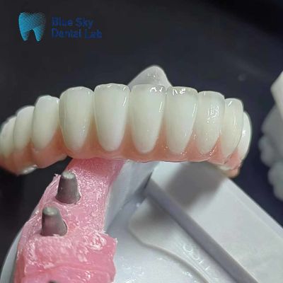 comprare Cassa per impianti dentali circonia regolare Cassa per impianti dentali personalizzati online manufacture