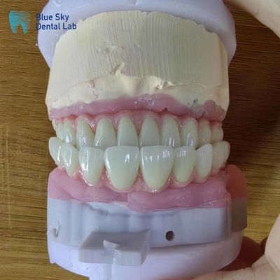 comprare Impianti dentali artificiali a arco completo Casse di operazione per procedure chirurgiche online manufacture