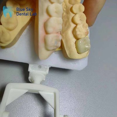 comprare Corone di zirconia resistenti alla corrosione di aspetto naturale denti di zirconia online manufacture