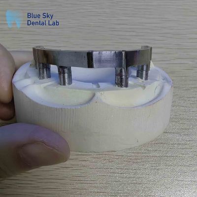 comprare Barre di titanio dentistiche di precisione Barre di titanio lucidate per impianti dentali online manufacture