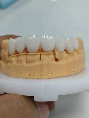 comprare Corone di zirconia stratificate da 5 mm a 6 mm online manufacture