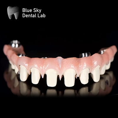 comprare Sistema di impianto dentale a titanio puro Malo Bridge Blue Sky online manufacture