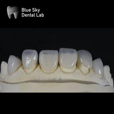 comprare Casse di rivestimento ultra sottile e elegante 0,3 mm Rivestimenti personalizzati più sottili online manufacture
