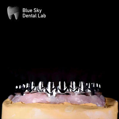 comprare Puro telaio in metallo di titanio Dental Malo ponti per argento e oro colore telaio online manufacture