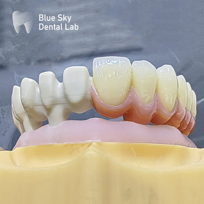 comprare Customizzare le casse per impianti a colori con design naturale di superficie liscia per una compatibilità universale online manufacture