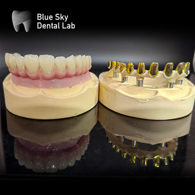 comprare Perno conservato MUA pilastro Impianto Casse corona di zirconia porcellana rosa multilivello con facile riparazione online manufacture