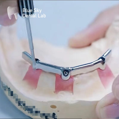 comprare Bar di titanio dentale di precisione con allegato prezioso Biocompatibile online manufacture