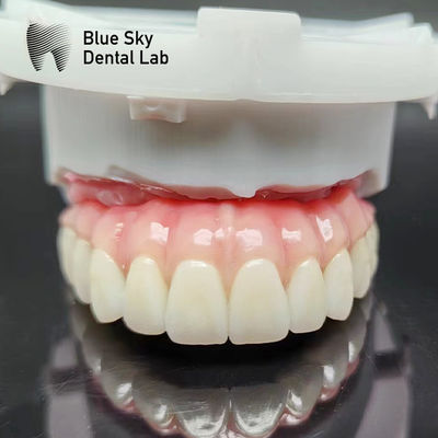 comprare Casse per impianti dentali naturali Casse per impianti dentali lisce per sistema di impianti online manufacture