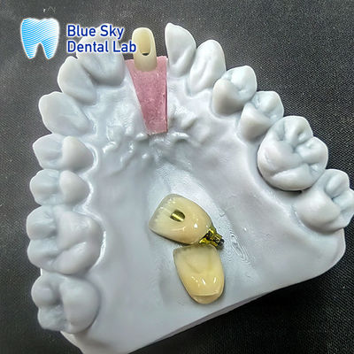 comprare Abutment in zirconia fresata a precisione con corona singola impianto online manufacture