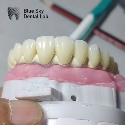 comprare Cassa per impianti dentali universali compatibile con sistemi di impianti multipli online manufacture