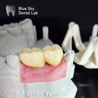 comprare Casse per impianti di superficie liscia Casse per impianti dentali di sterilizzazione a vapore online manufacture