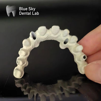 comprare Ponte a telaio in titanio Dental Custom Malo Implant Bridge online manufacture