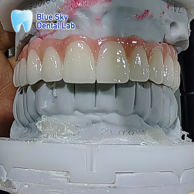 comprare Casse per impianti dentali artificiali Casse per impianti dentali di sterilizzazione multipla online manufacture