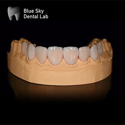comprare Casse di rivestimento dentale rettangolare leggero con montatura passiva Solo 0,3 mm online manufacture
