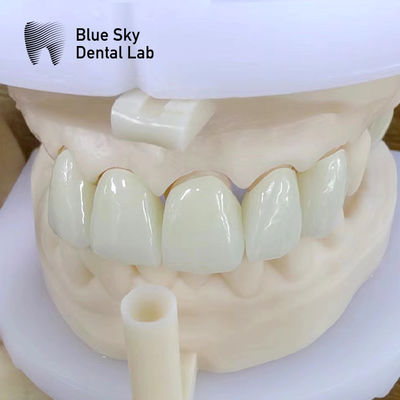 comprare Estetica naturale Corona di zirconia a più strati Alta resistenza chimica online manufacture
