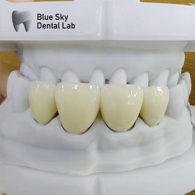 comprare Naturale apparenza stratificata zirconia alta resistenza zircone multilivello rettangolare online manufacture