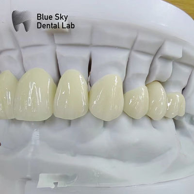 comprare Corona di zirconio a strati traslucidi Restauro dentale Corona di zirconio a più strati online manufacture