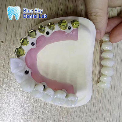 comprare Casse universali per impianti dentali a arco completo per impianti regolari multipli online manufacture