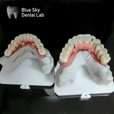 comprare Implantazione di cielo blu Casse di impianto di arco completo Casse di impianto di natura online manufacture