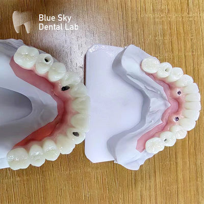 comprare Casse per impianti dentali multi-implantato Casse per impianti personalizzate online manufacture