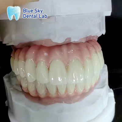 comprare Natura e durata degli impianti dentali per apparecchiature mediche online manufacture