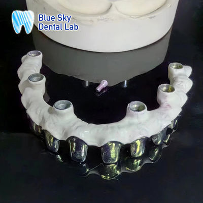 comprare Puro Titanio Ponte Malo Denti a struttura metallica d' argento personalizzabili online manufacture