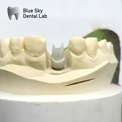 comprare Impianto estetico di zirconia di abbraccio Biocompatibile Precisione fresata online manufacture