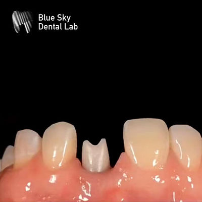 comprare Impianto dentale ipoallergenico online manufacture