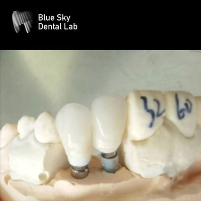 comprare Impianto dentale ipoallergenico Impianto dentale circonico online manufacture