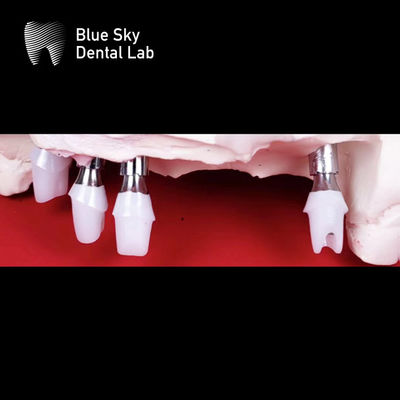 comprare Impianti dentali di ceramica di zirconia precisi online manufacture