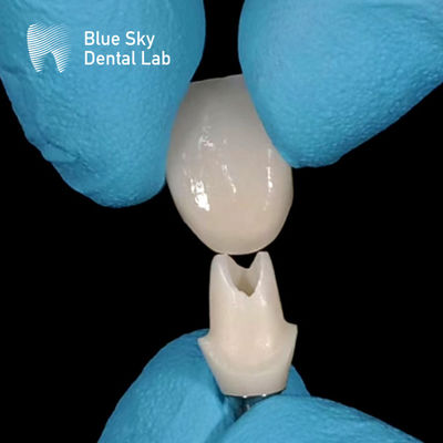 comprare Scansione orale Abutment di zirconio personalizzato Abutments di zirconio ad alta resistenza online manufacture