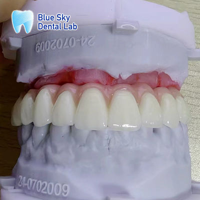 comprare Personalizzare il colore della superficie liscia Implantazione strumento Case online manufacture