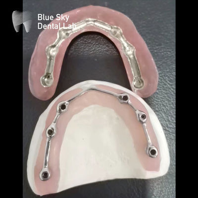 comprare Bar di titanio dentale con protesi dentali acriliche per impianti dentali online manufacture