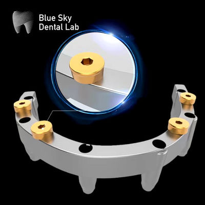 comprare Dentiera in titanio con inserzione di un localizzatore rimovibile online manufacture
