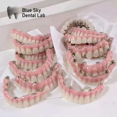 comprare Casse per impianti Blue Sky con ponte a telaio malo in titanio puro online manufacture