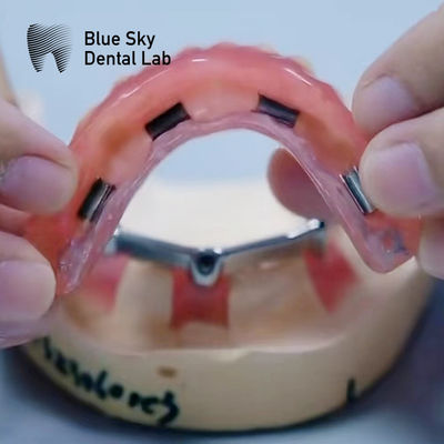 comprare Dentiera di Titanio Dental Acrilica Con Appendici d'Argento E Oro online manufacture