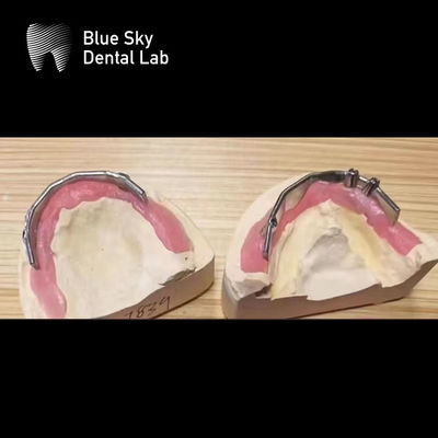 comprare Impianti dentali Blue Sky Bar di titanio argento per impianti dentali online manufacture