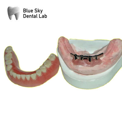 comprare Bar di titanio rimovibile per denti blu cielo online manufacture