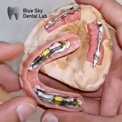 comprare Impianti dentali Blue Sky con barre di titanio per protesi rimovibili online manufacture