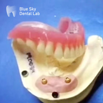 comprare Locatore dentale in titanio con dentiera rimovibile e attacchi a cappello a sfera online manufacture