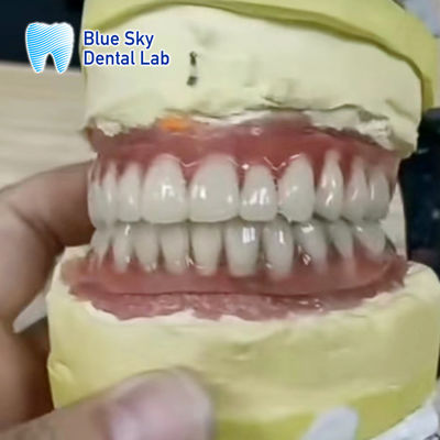 comprare Impianti dentali a base di titanio a base di titanio e a base di titanio online manufacture