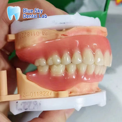 comprare Dentiera acrilica rimovibile a arco pieno Dentiera personalizzabile dall'aspetto naturale online manufacture
