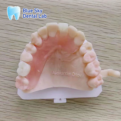 comprare Protesi parziali in valplast rimovibili di aspetto naturale per denti anteriori e posteriori superiori online manufacture