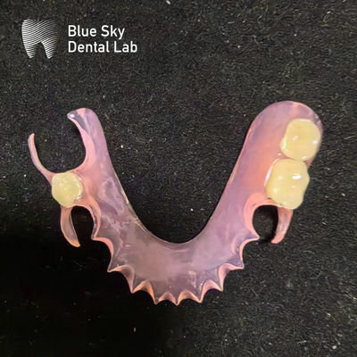 comprare Personalizzare dentiere parziale rimovibile acrilico dall'aspetto naturale online manufacture