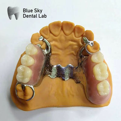 comprare Dental Cast Partial Denture Framework Partial Dentures che sembrano reali online manufacture